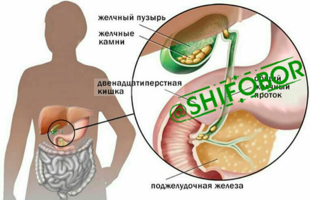 влияние желчи на стул