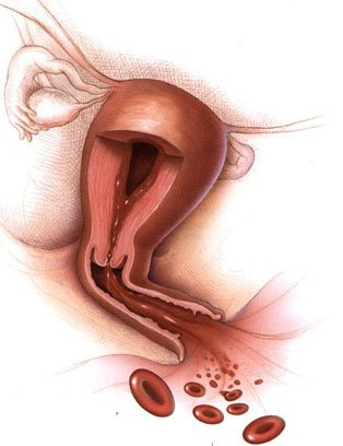 Kadınlar ve mevcut tıp bilim düzeyimiz vajinanın kan'a dirençli, uyumlu olduğuna amansızca inanmışlık içerisindedir. Oysaki vajina kan'a hiç dayanıklı değildir. Vajina içerisinde fazladan bulunacak bir damla kan çeşitli mekanizmalar ile tüm bedeni etkileyecek çeşitli hastalıkları tetiklemektedir.