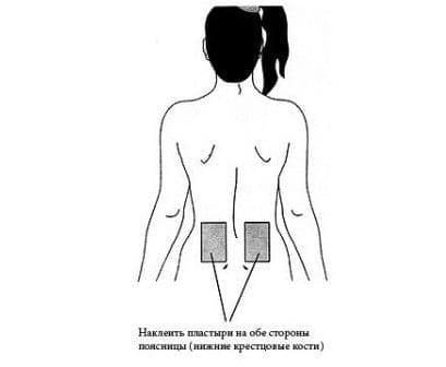 При невралгии можно перцовый пластырь