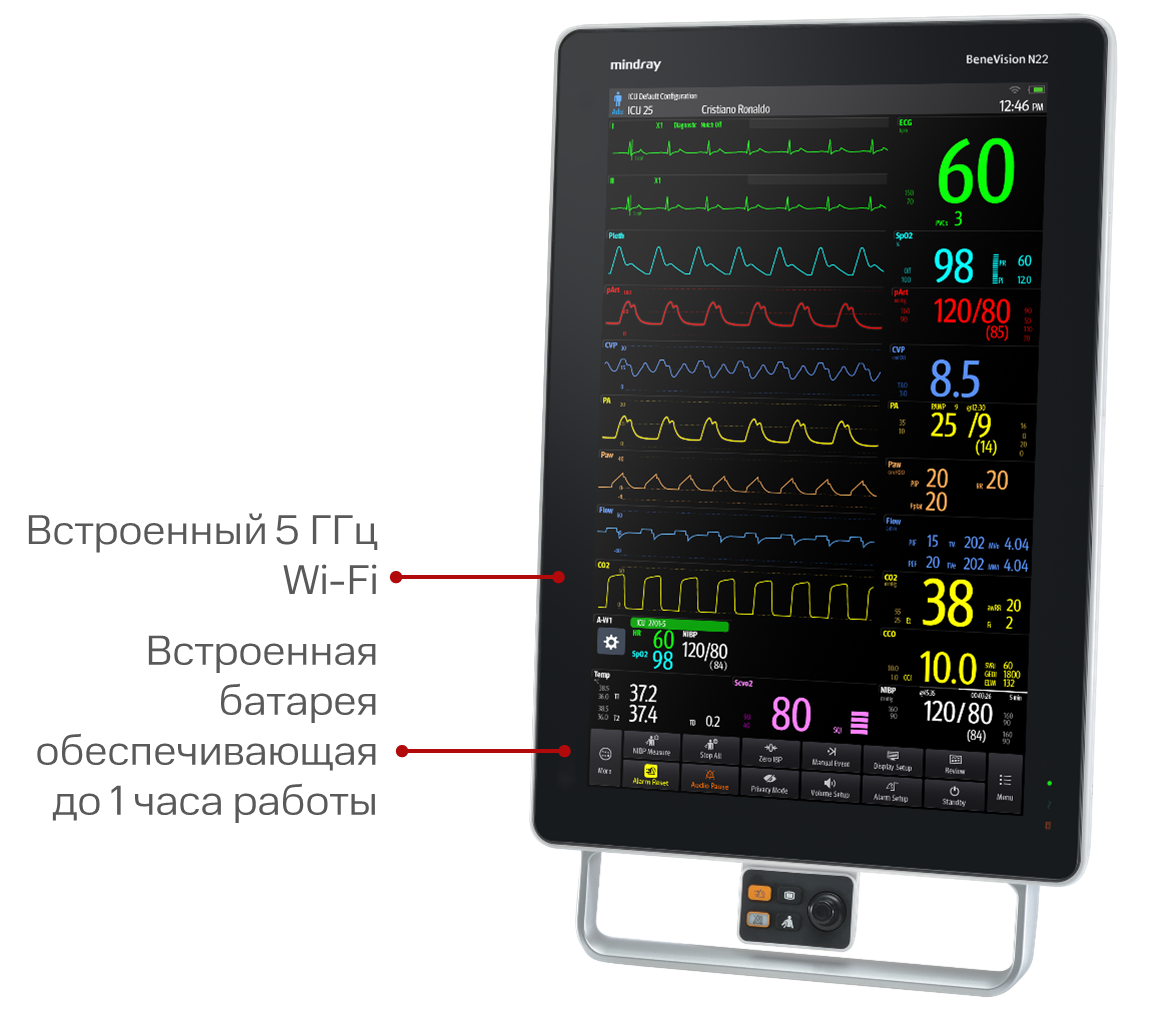 Как устроены мониторы пациента Benevision N19 и N22 — Статьи — MEDFORD