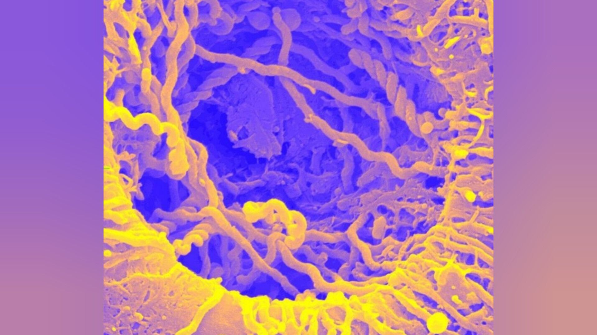 Лептоспироз – Telegraph