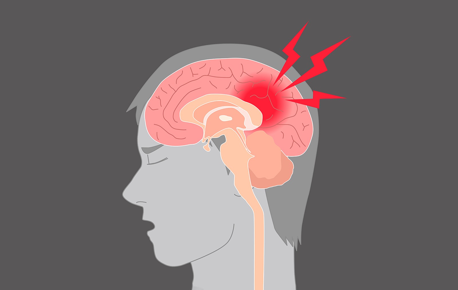 Проблемы с головным мозгом симптомы. Контузия головного мозга.