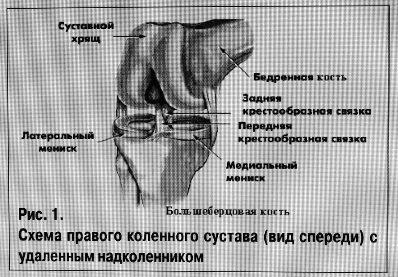 Передняя связка бедра