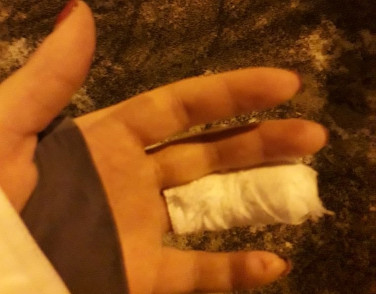 В Приморье таксист откусил палец пассажирке