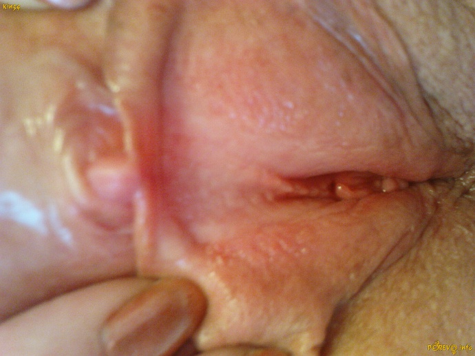 [Image: 157e22e8b50670bf6dc1a.jpg]