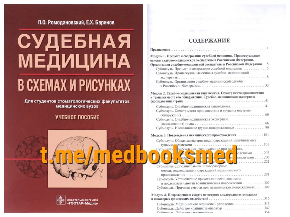 Ромодановский судебная медицина в схемах и рисунках