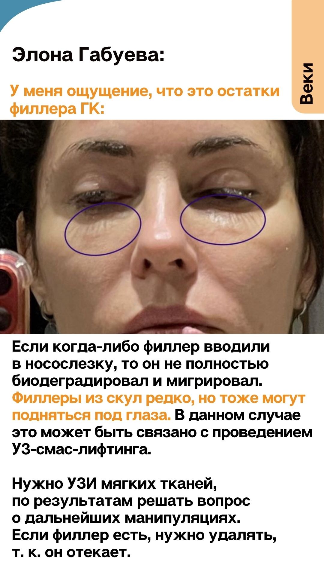 Разбор: жир уходит, складки приходят – Telegraph