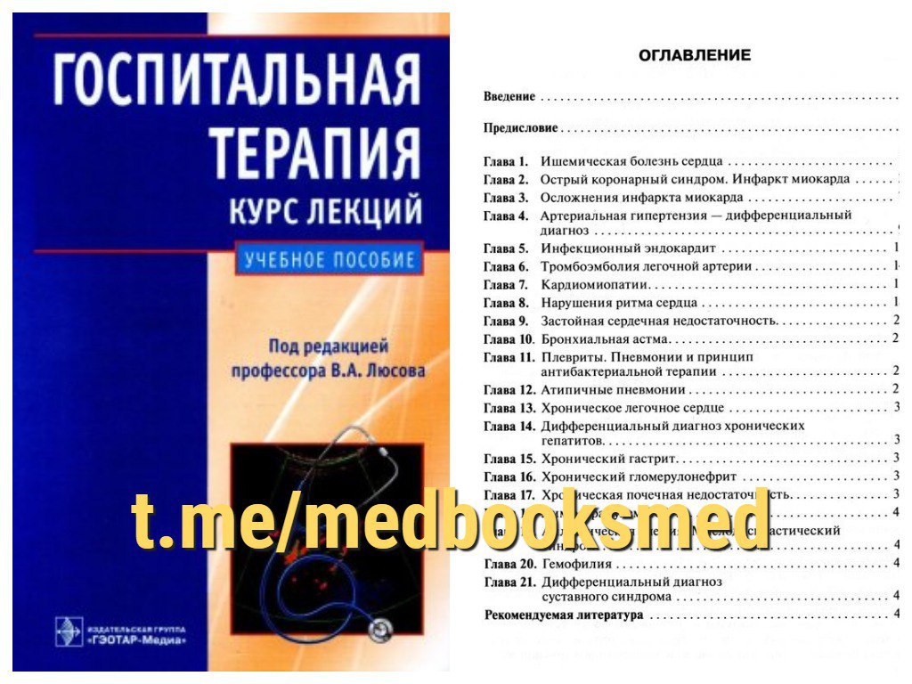 Госпитальная терапия курс. Госпитальная терапия учебник. Лекции по терапии. Госпитальная терапия Люсова.