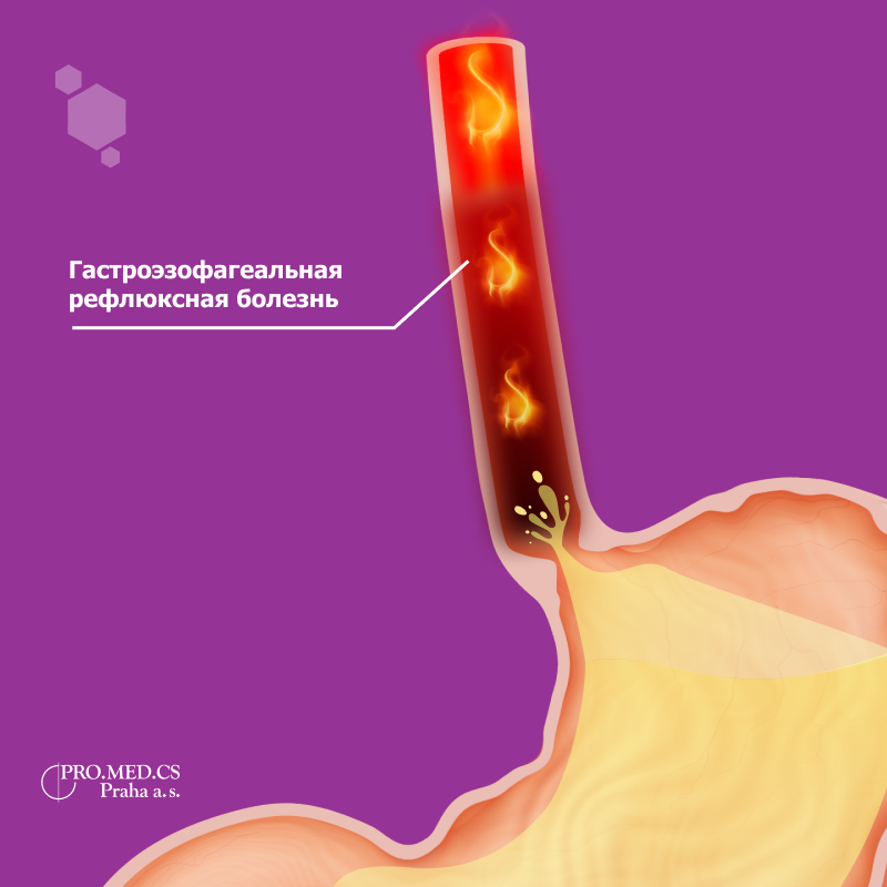 Дифференцировка диагноза – Telegraph
