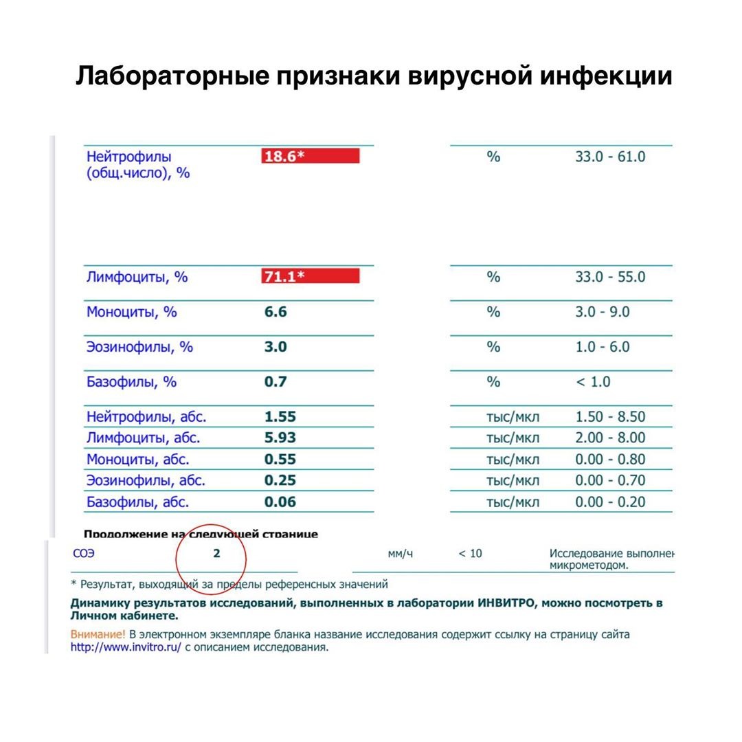 Инвитро анализ срб