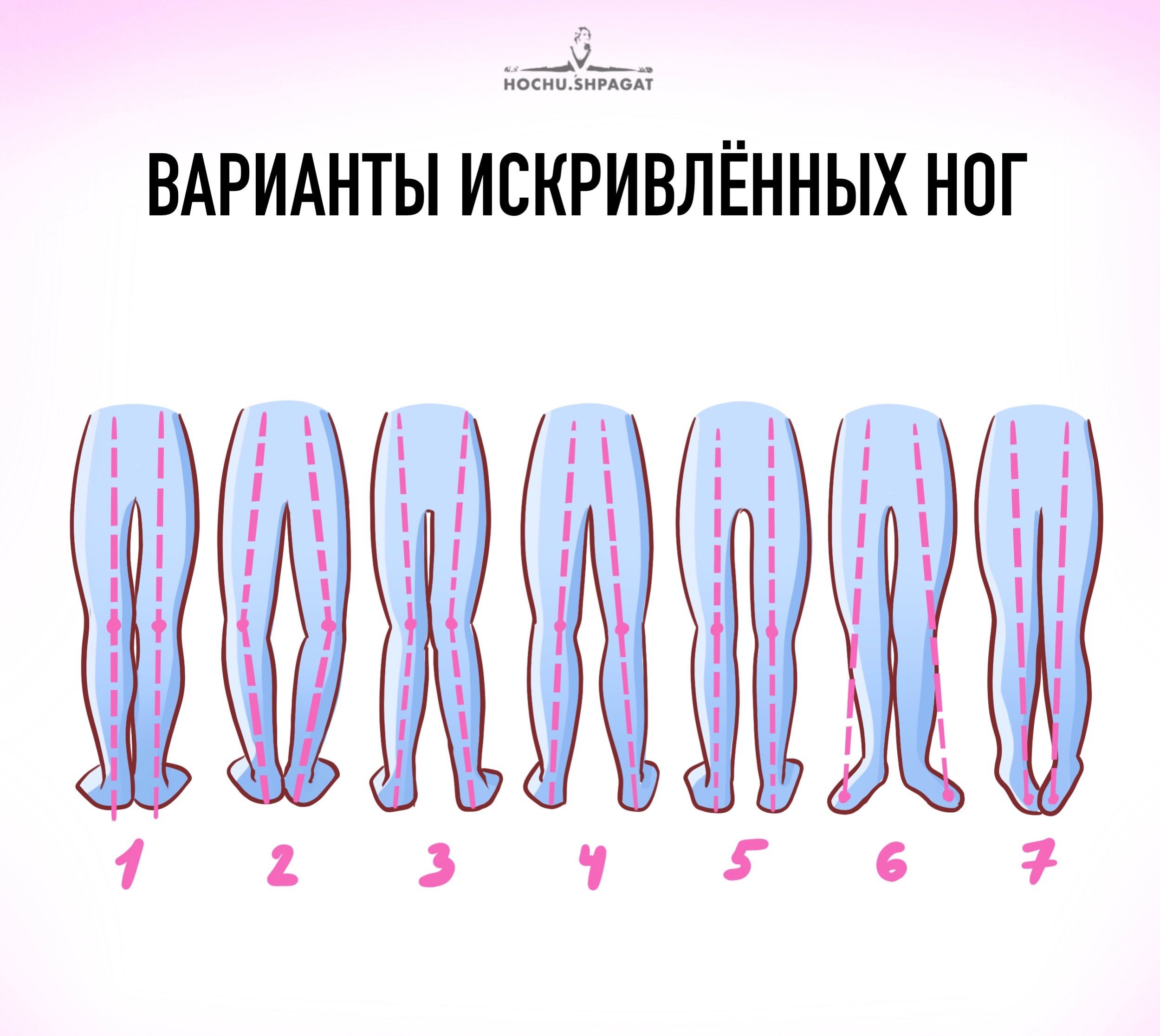 Почему быстро растут ноги. Откуда растут ноги. Откуда у женщин ноги растут.