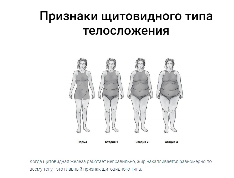 Щитовидная полнота. Щитовидный Тип телосложения Берг. Доктор Берг щитовидный Тип телосложения. Доктор Берг 4 типа телосложения. Щитовидный Тип фигуры.