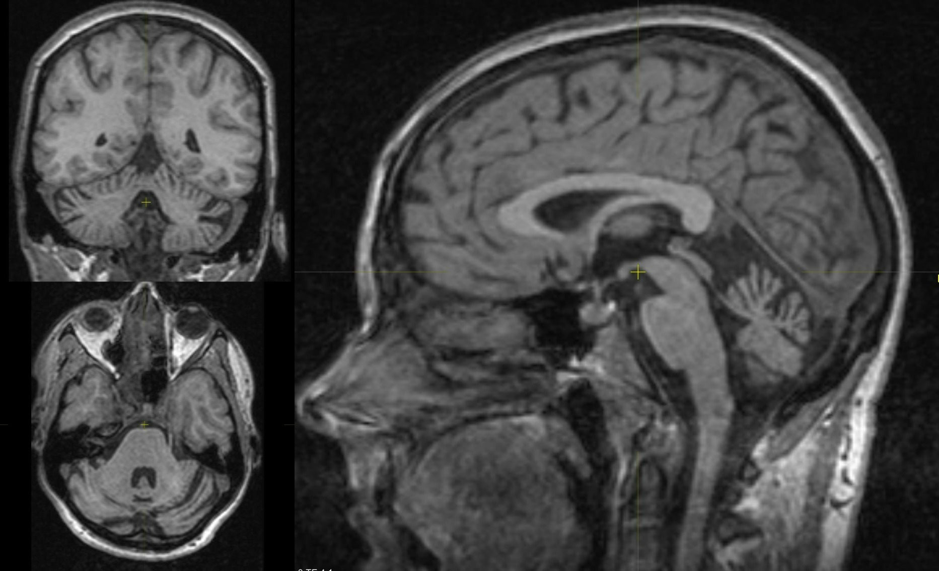 Ответ на глазах – Telegraph
