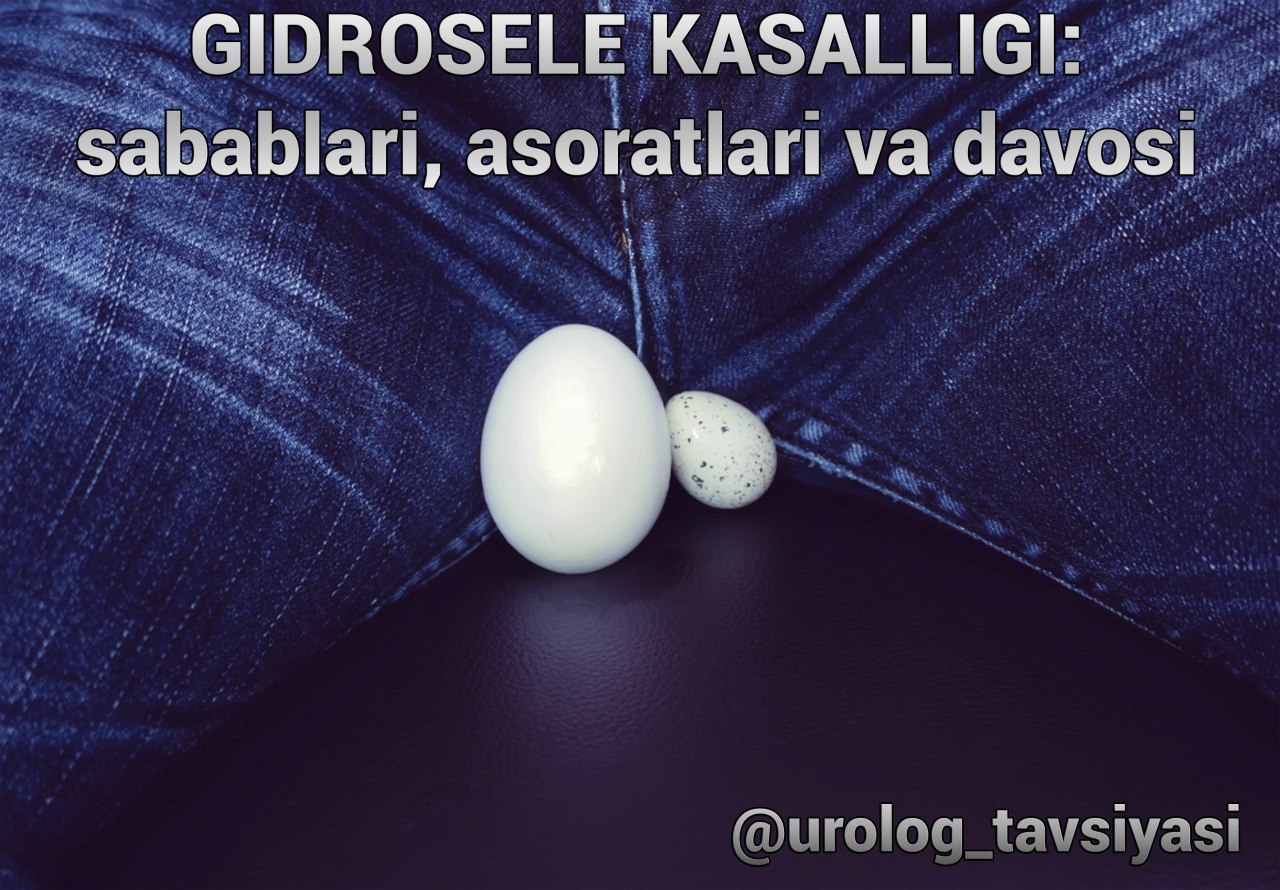 Ehtirosli uzoq jinsiy aloqa