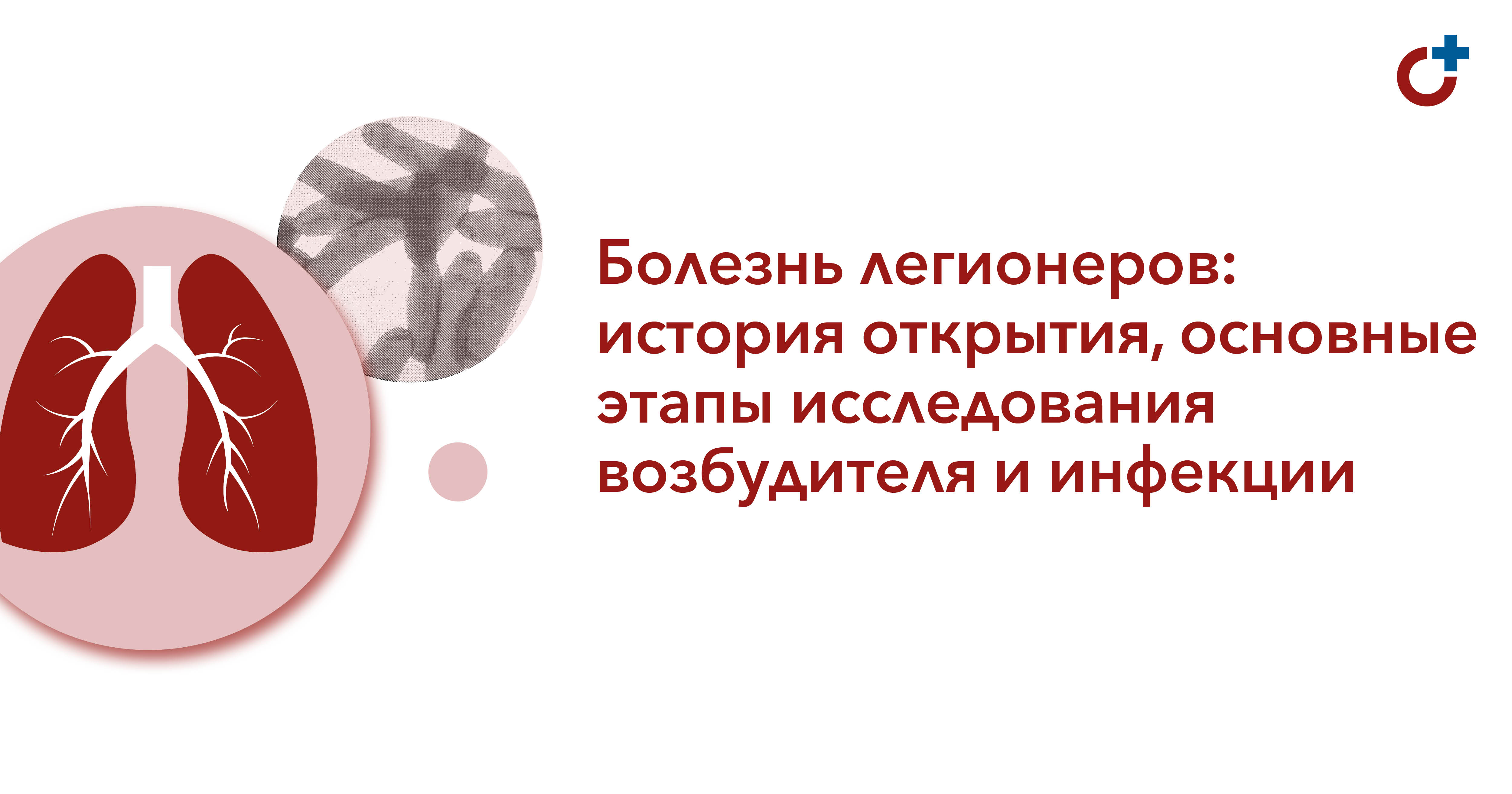 Болезнь легионеров от кондиционера. Болезнь легионеров. Возбудитель болезни легионеров. Болезнь легионеров история.