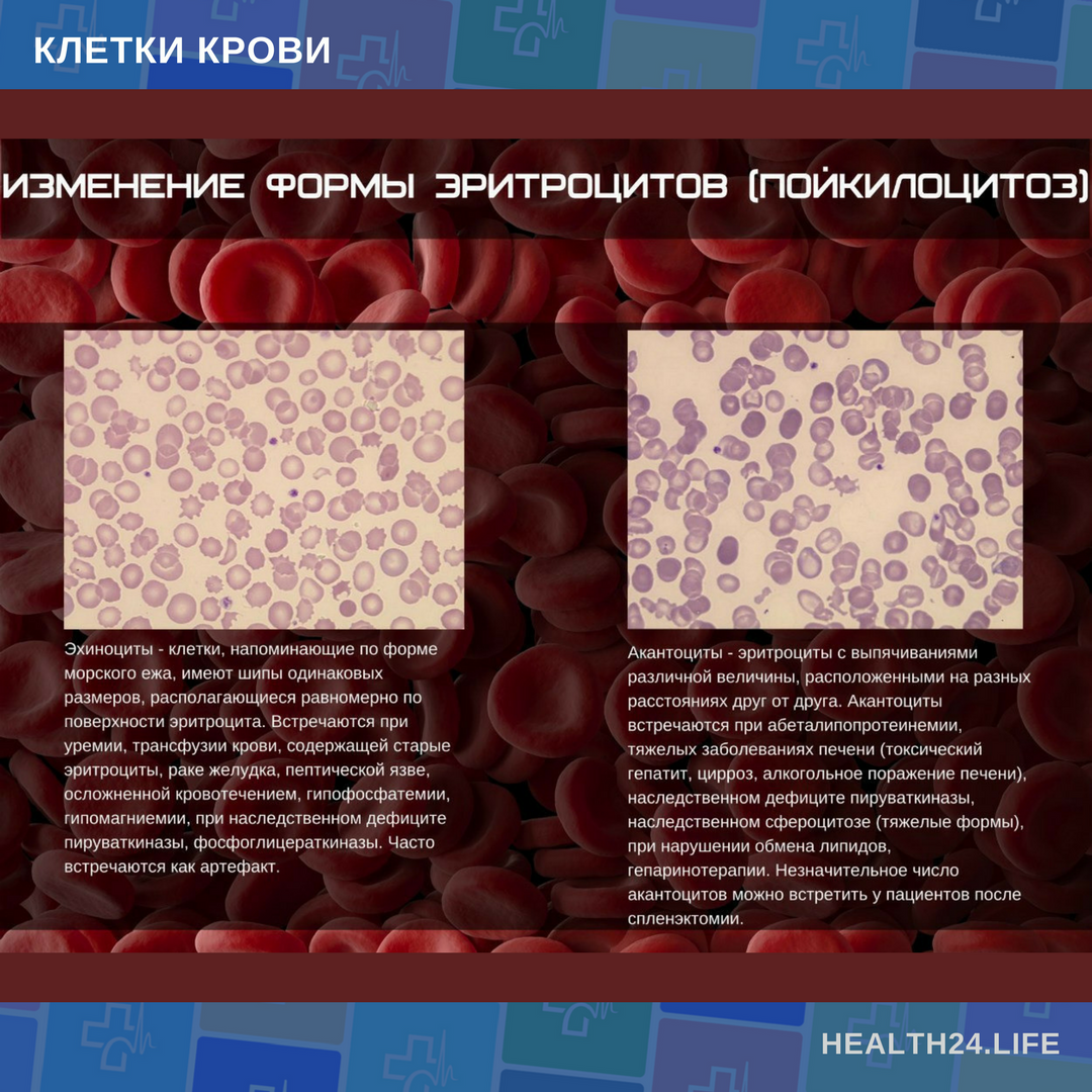 Формы эритроцитов эхиноциты. Размеры клеток крови. Эхиноциты эритроциты. Эритроциты в крови акантоциты. Эхиноциты
