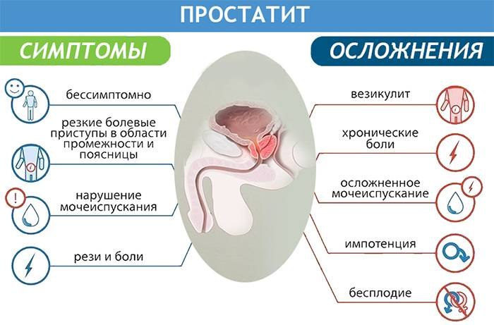 Какой Секс При Простатите