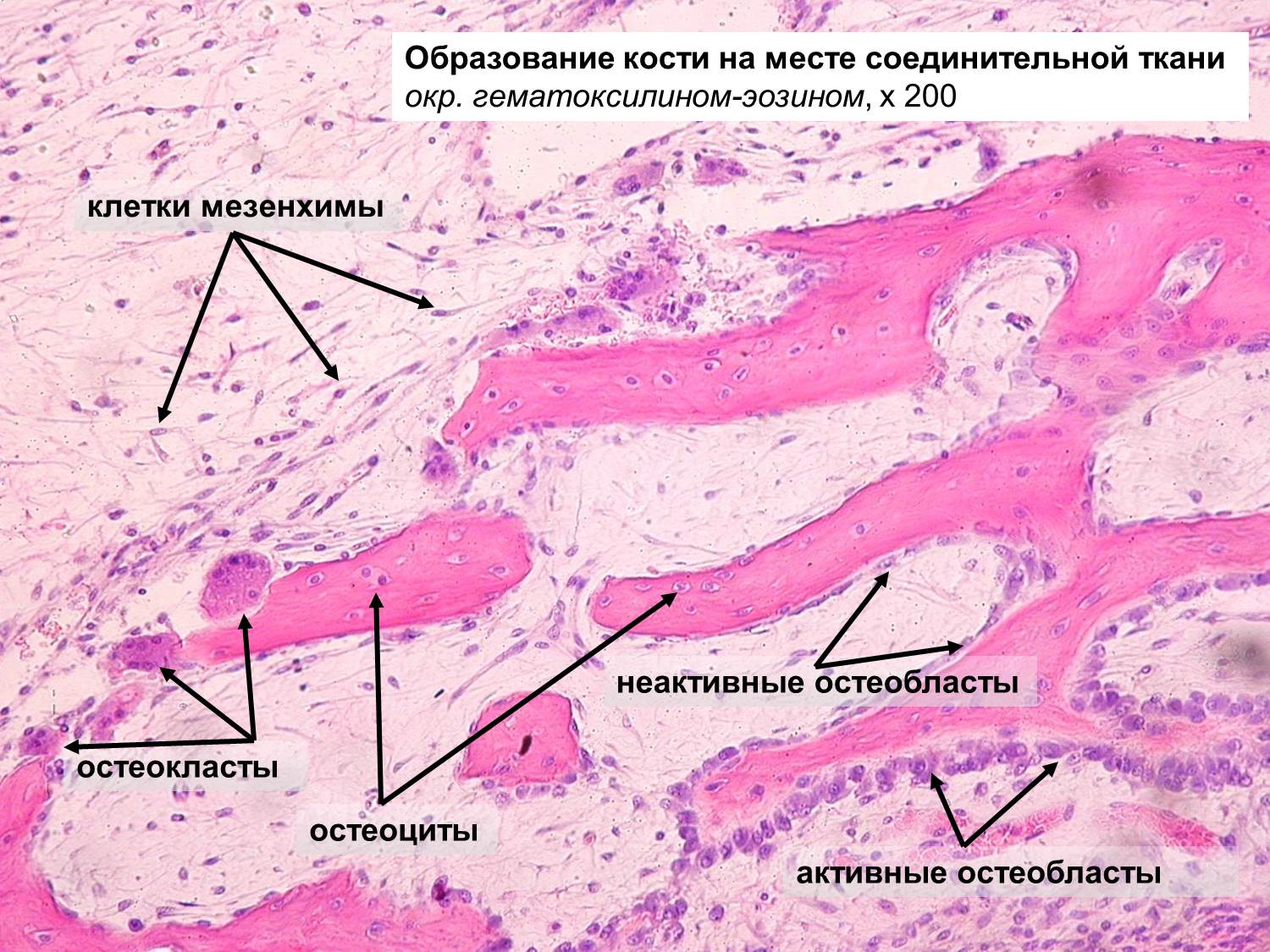 Развитие кости из мезенхимы препарат гистология