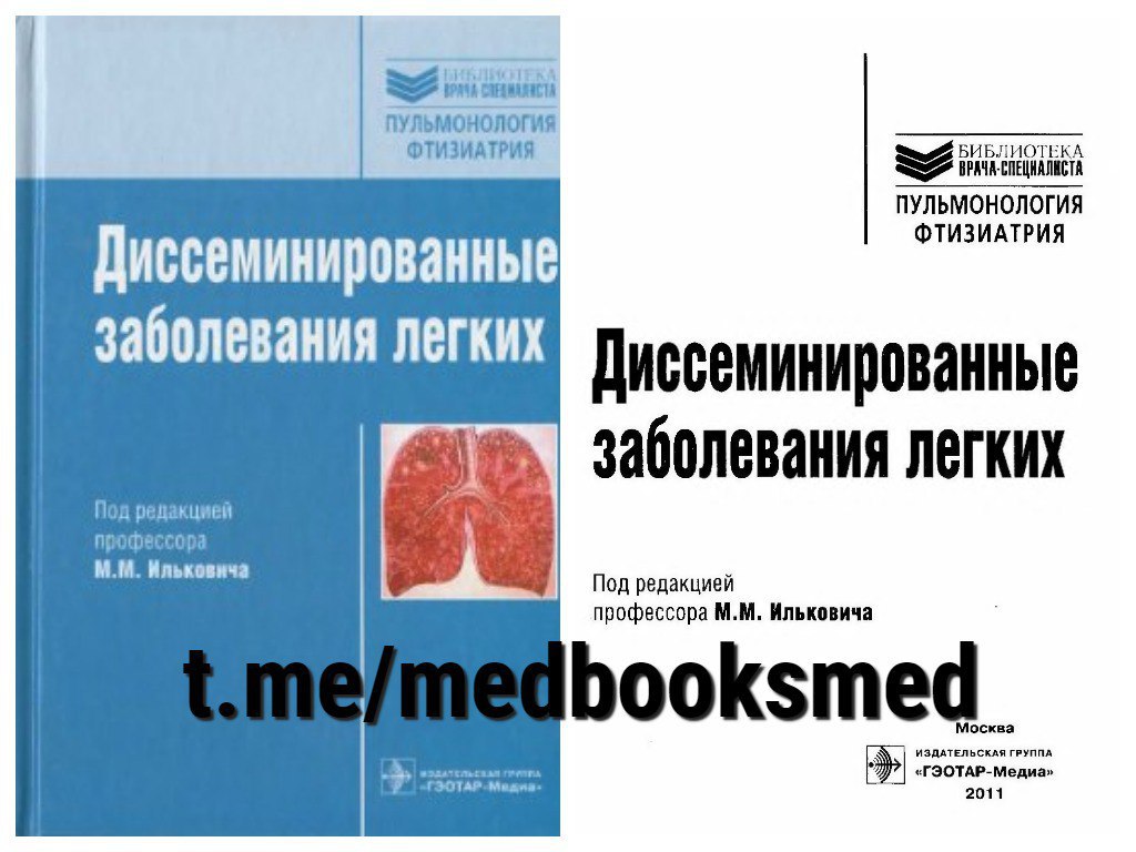 Пульмонология фтизиатрия. Илькович интерстициальные заболевания легких. Пульмонология книги. Пульмонология книги интересные. Фтизиатрия и пульмонология.