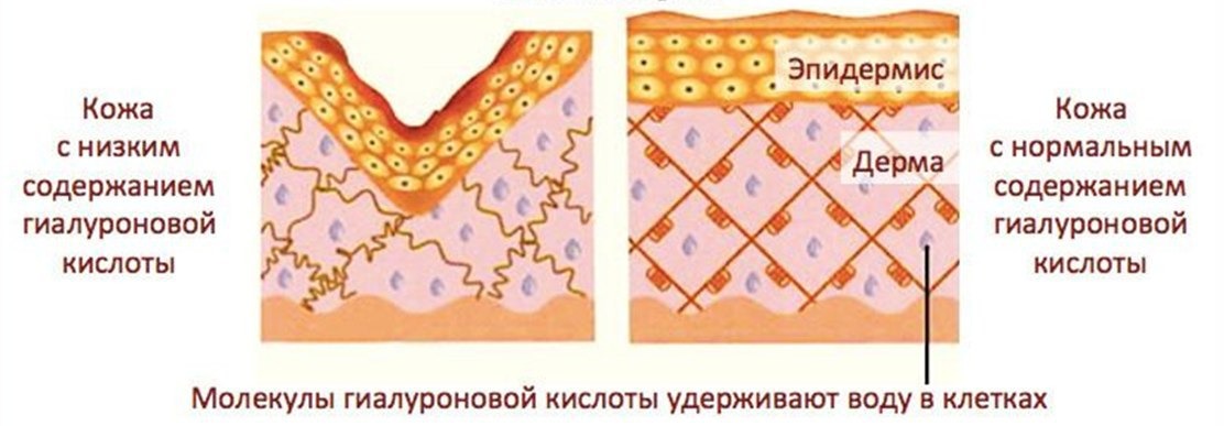 Клетки гиалуроновой кислоты