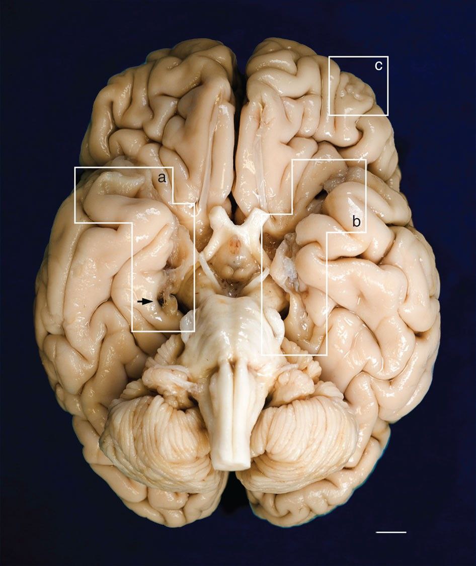 Складчатая поверхность головного мозга