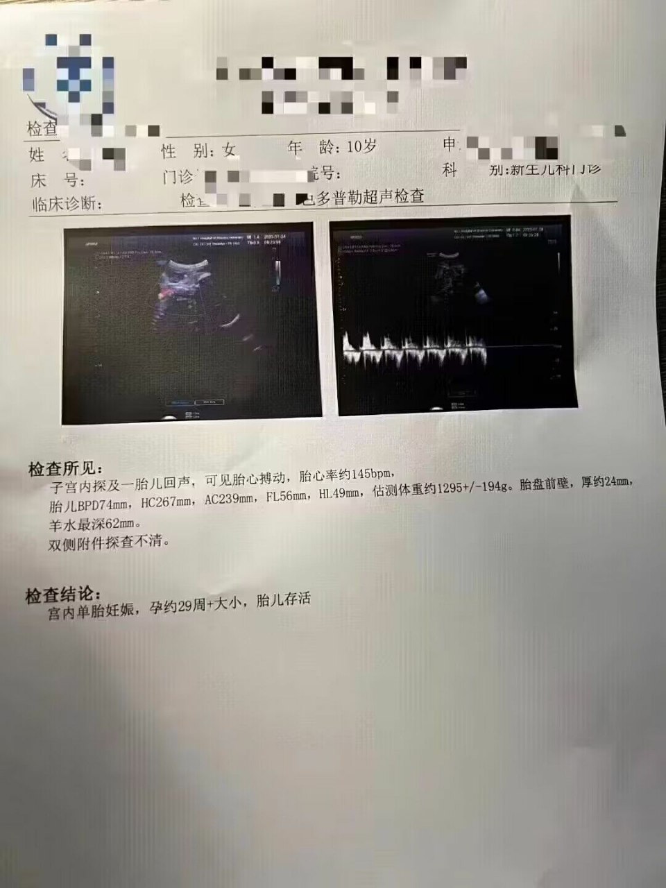 https://telegra.ph/file/4d3a6993d358cbfc39613.jpg