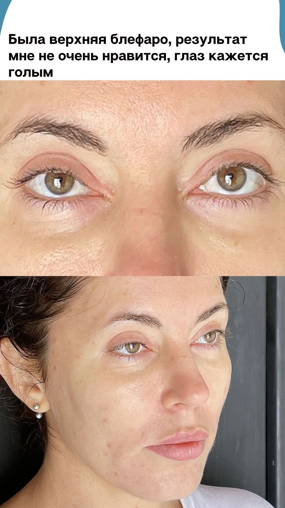 Разбор: жир уходит, складки приходят – Telegraph