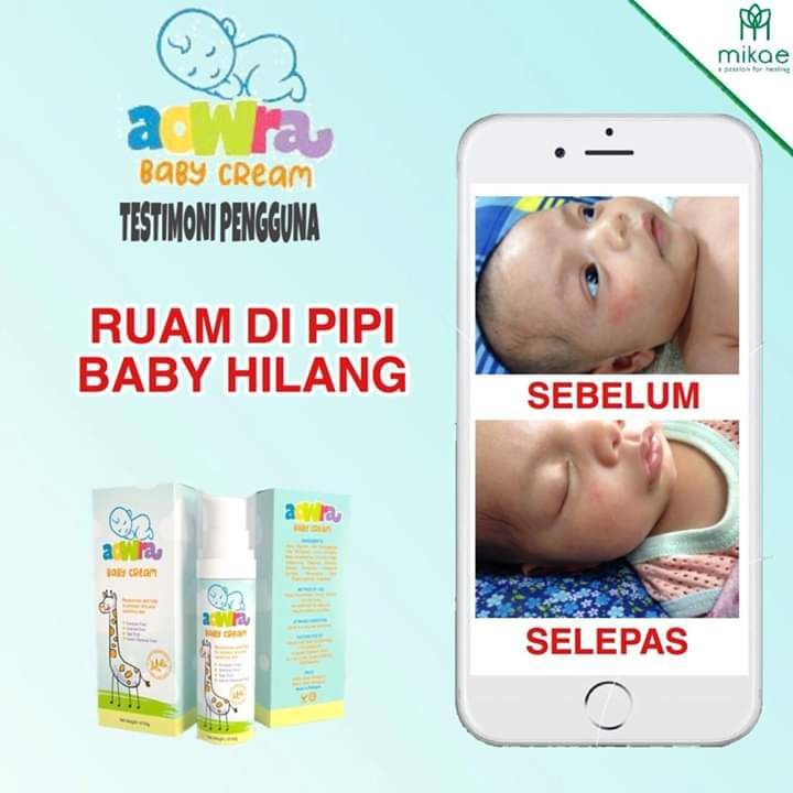 Aowra Baby Cream Telegraph