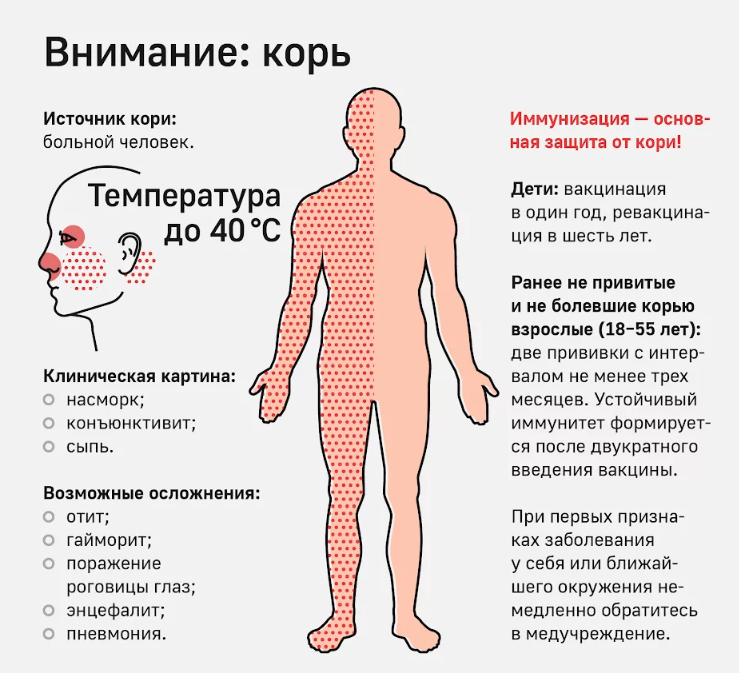 Корь ветрянка одно тоже