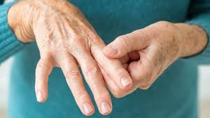 romatoid artrit Romatolojik Hastalıklar, Menisküs Eklem Hasarı , Jinekoloji ellerini gösterme hastalığı