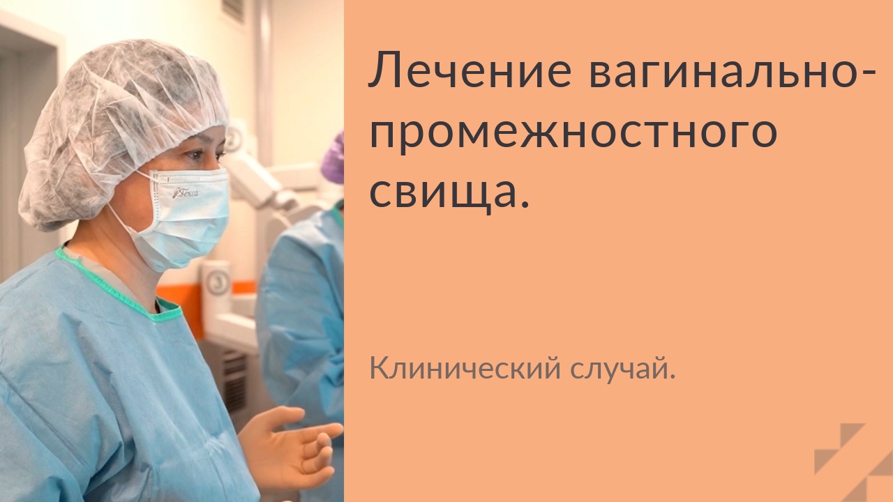 Лечение вагинально-промежностного свища. – Telegraph
