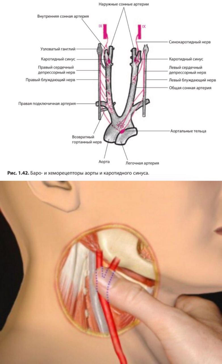 Массаж каротидного синуса фото