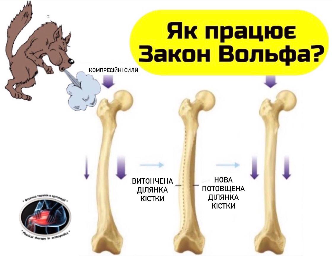 Закон вольфа рост костей. Закон Вольффа. Закон Вольфа кости. Закон Вольфа адаптация костной. Закон Вольфа и закон Дэвиса.