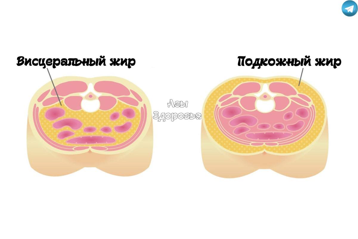 Подкожный жир