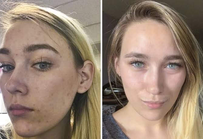 Витамин А – Telegraph