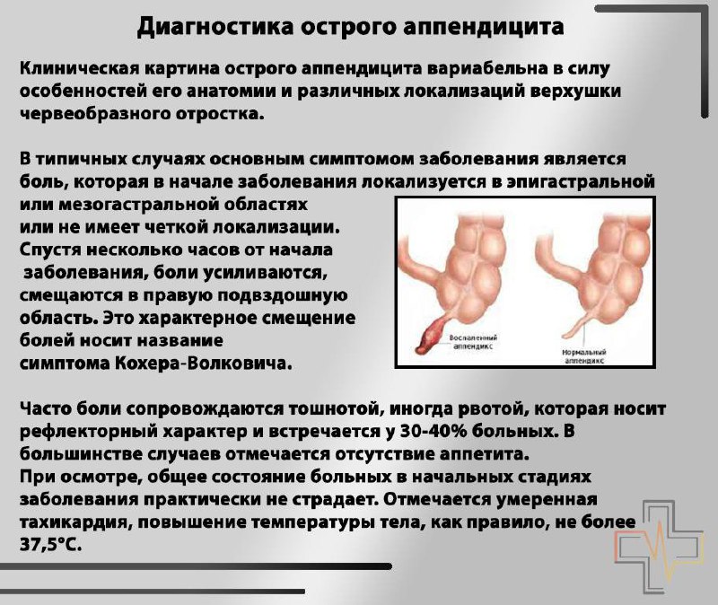 Нормы аппендицита. План обследования при остром аппендиците. Перкуссия живота при остром аппендиците. Симптомы острого аппендицита. Синдромы ы аппендицита.