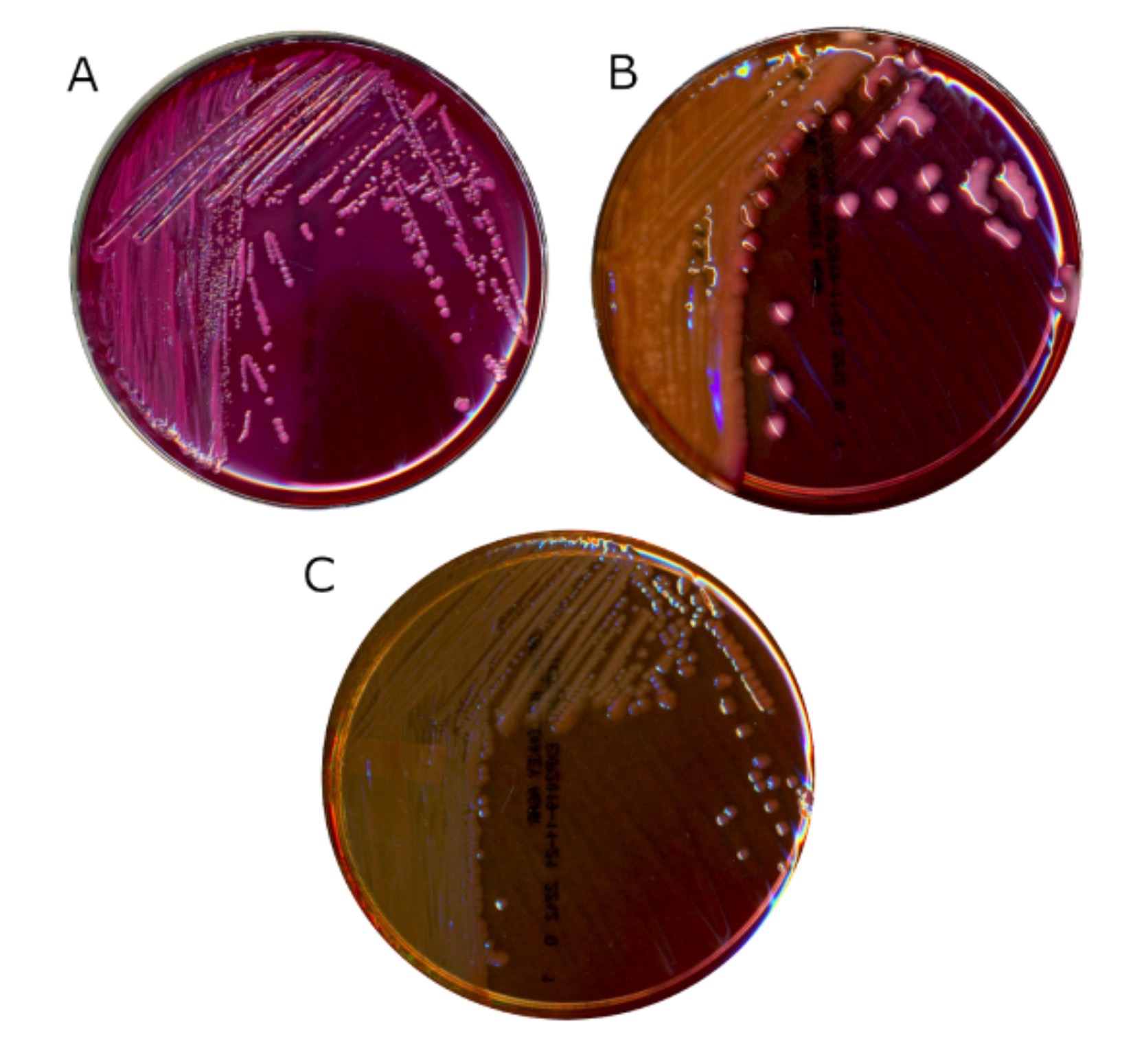 Escherichia coli лактозонегативная