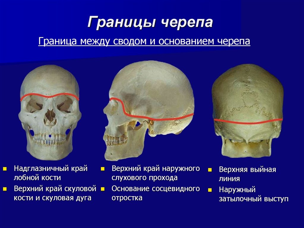 Нижняя лицевая сторона. Основание черепа и свод черепа анатомия. Костный свод и основание черепа. Мозговой череп свод и основание. Граница свода и основания черепа.
