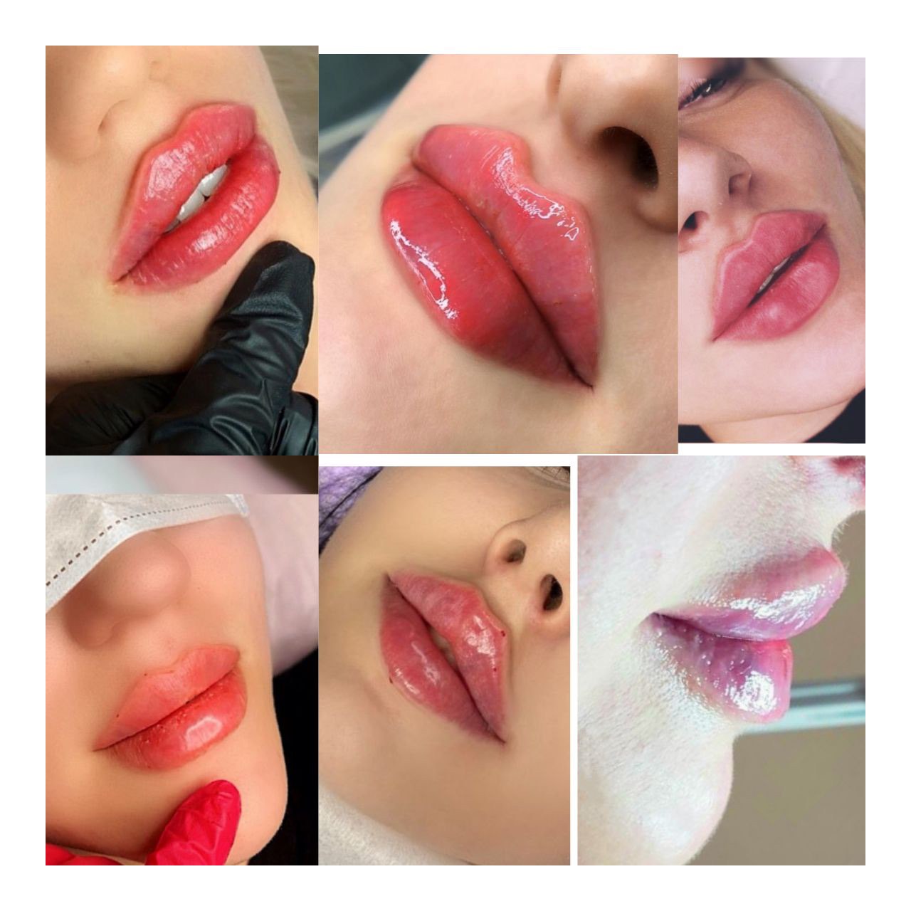 Техники увеличения губ с фото. Форма губ для увеличения. Увеличенные губы красивые.