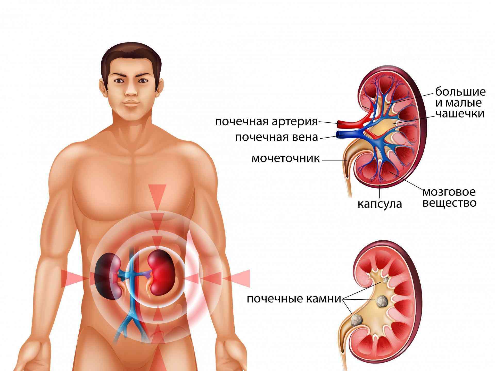 Болезни почек у мужчин