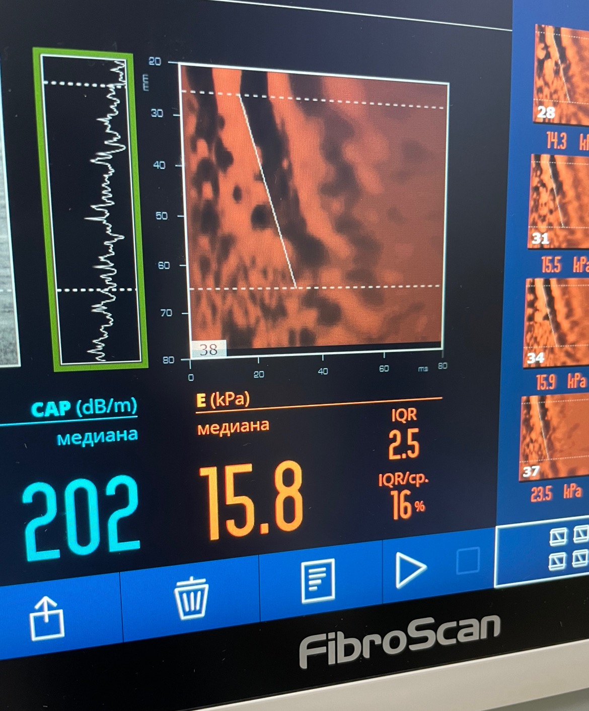История ПБХ/АИГ – Telegraph