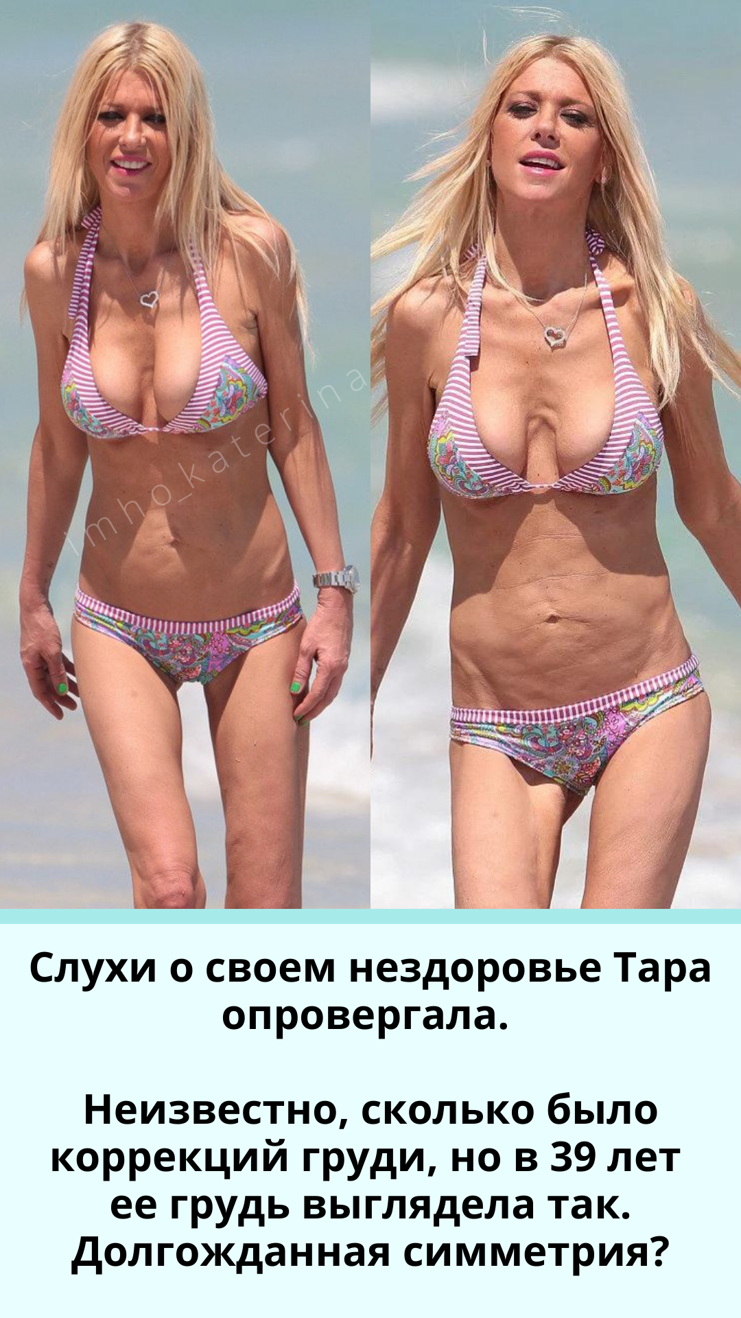 асимметрия груди у женщин форум фото 110