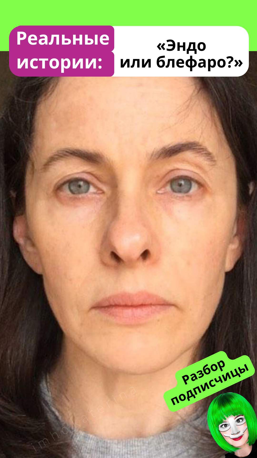 Разбор подписчицы – Telegraph