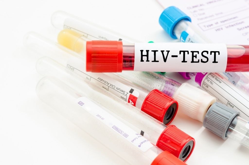 Всероссийская неделя тестирования на ВИЧ проходит в Хабаровске
