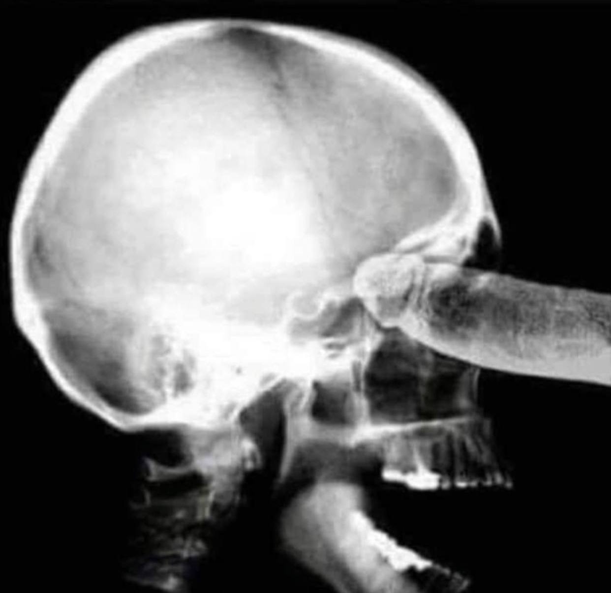 рентген с членом во рту фото 1