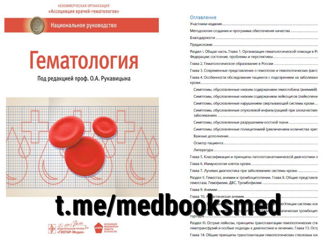 Гематология заболевания