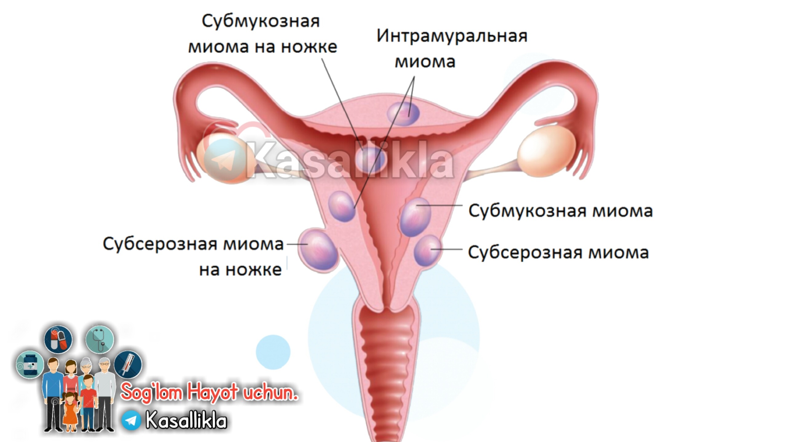 миома кончить можно фото 58