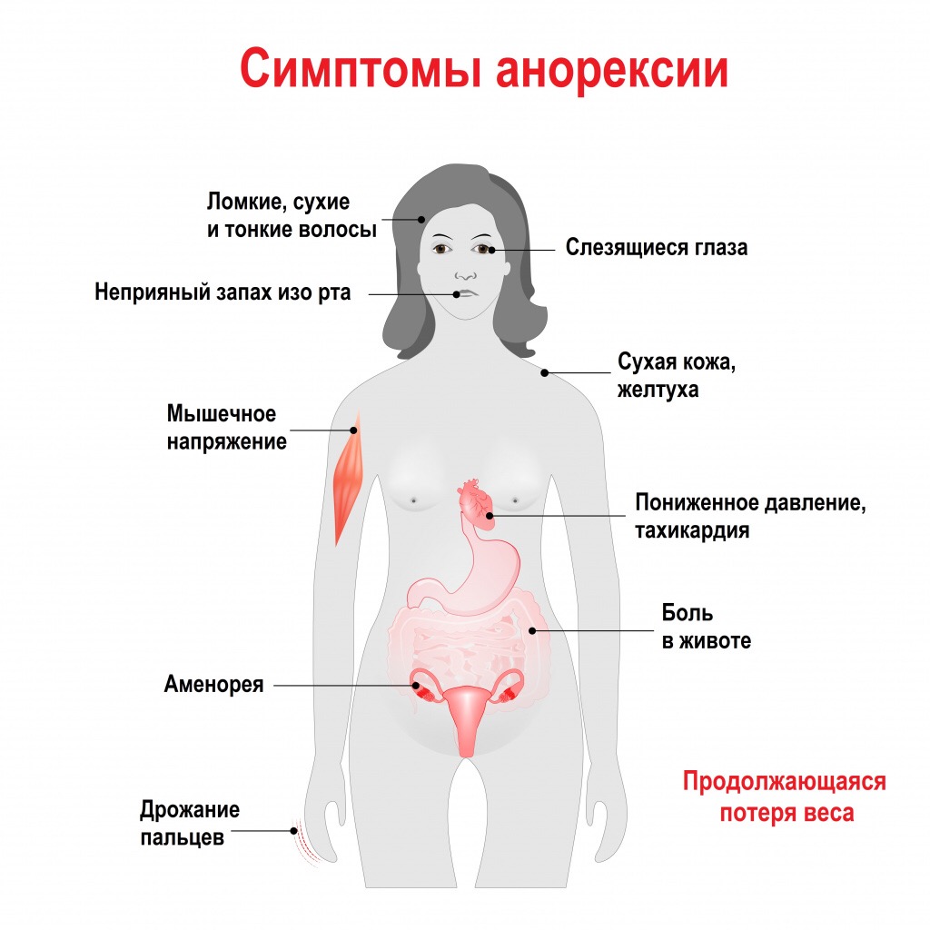 Признаки анорексии на ранних. Первые признаки анорексии. Внешние симптомы анорексии.