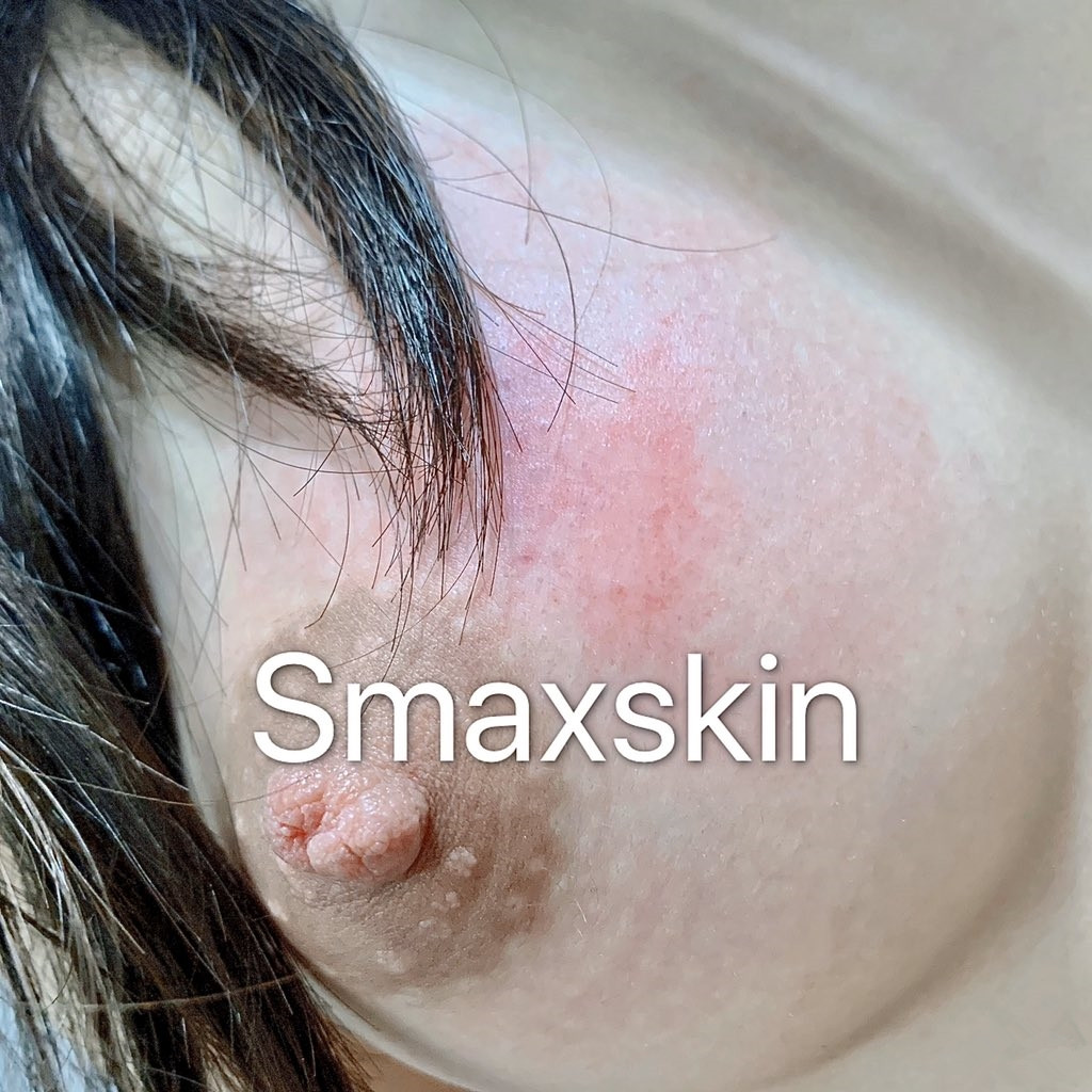 网络红人Smaxskin无圣光套图[90P] 57
