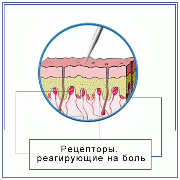 Раздражение рецепторов. Болевой анализатор рецепторы. Рецепторы кожи болевой чувствительности. Строение болевого рецептора. Ноцирецепторы кожи.